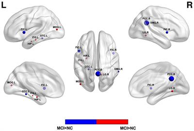 Advances in Resting State Neuroimaging of Mild Cognitive Impairment